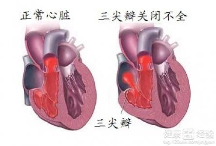 第1步