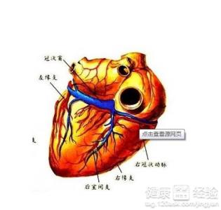 冠心病是怎麼樣患的