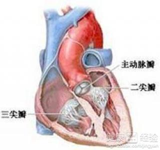 全心衰竭怎麼防止並發症的發生？