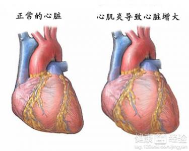 如何處理心髒病？