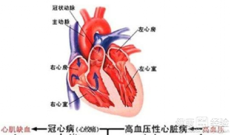 心腦血管疾病如何預防