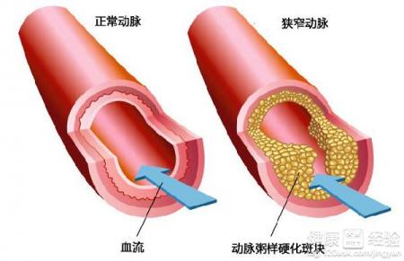 第1步