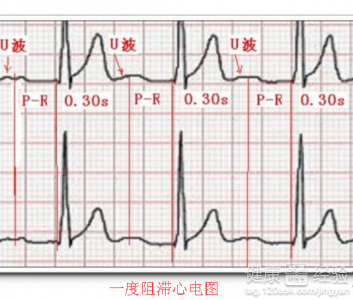 第1步