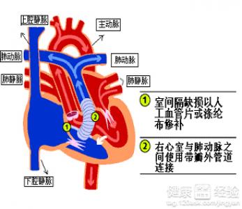 第1步