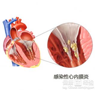 第1步