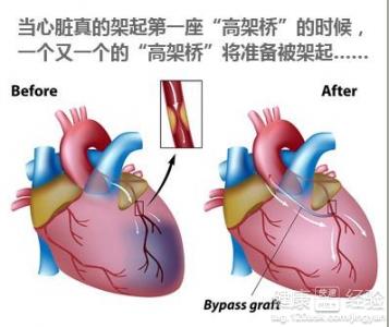 第1步