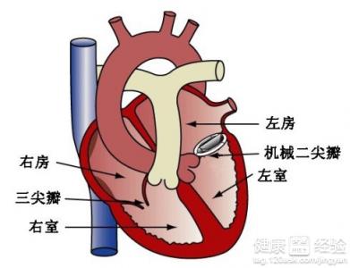 心髒瓣膜病的產生病因