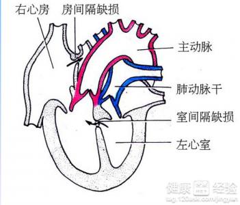 第2步