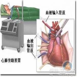 第2步