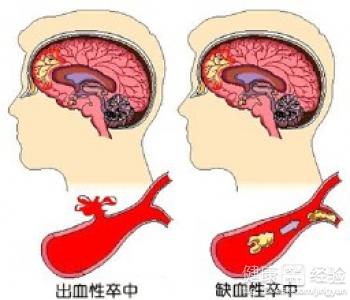 哪些因素易患腦血管疾病？