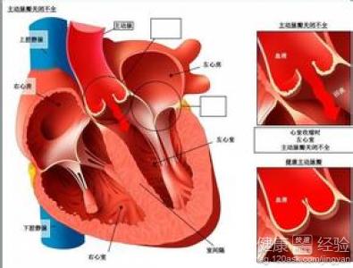 患上心腦血管疾病之前都有哪些前兆呢