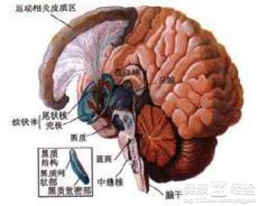 左手麻木是腦血管疾病嗎