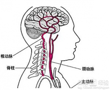 腦供血不足與心血不足的區別與聯系