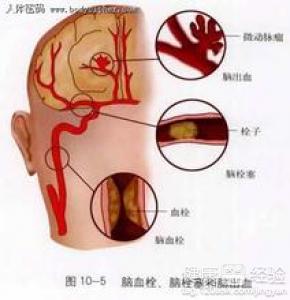 第1步