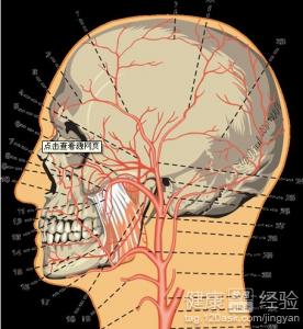 導致腦血管破裂的原因