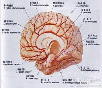 怎樣預防腦出血