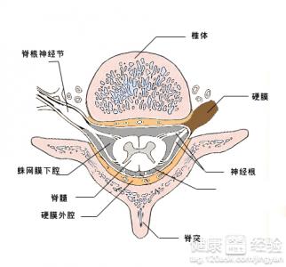 如何預防與治療腦血管疾病？