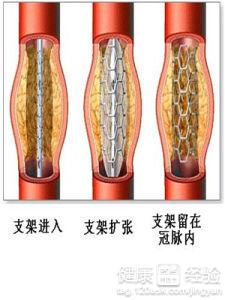 第3步