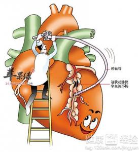 冠心病患者多吃山楂有助於身體健康!