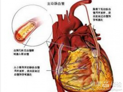 第1步