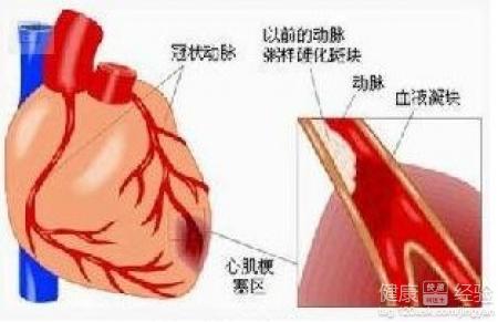 糖尿病冠心病人吃什麼水果好