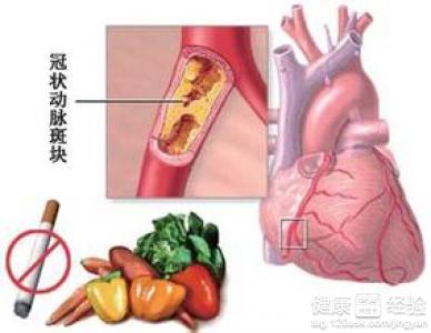 冠心病什麼症狀