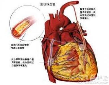 冠心病的中醫食療法