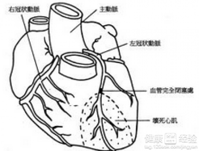 治療冠心病的藥物