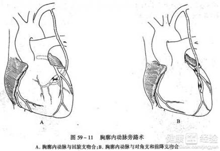 第1步