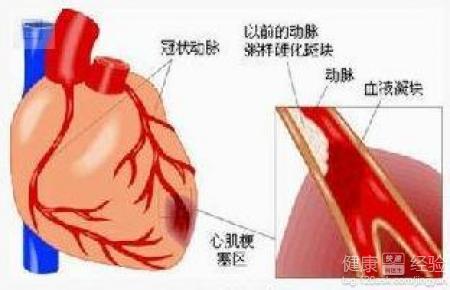 第1步