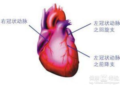 冠心病是怎樣引起的