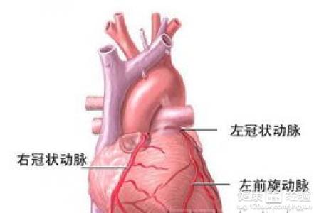 冠心病治療方法有哪些