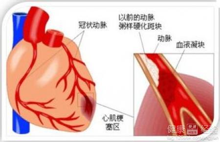 第1步