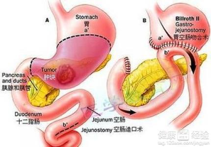 第1步