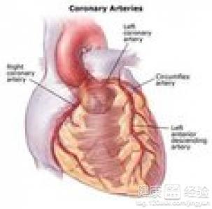 冠心病的飲食治療