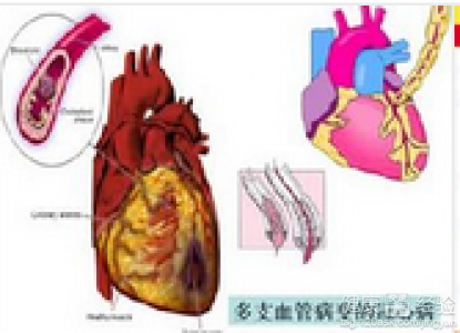 第1步