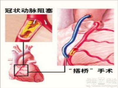 第3步