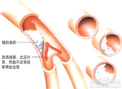 第3步