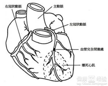 第1步