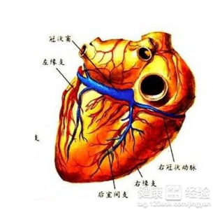 夏季冠心病的人要注意哪些?