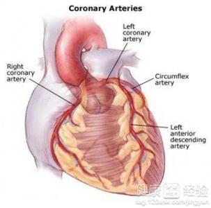 有冠心病怎麼辦？