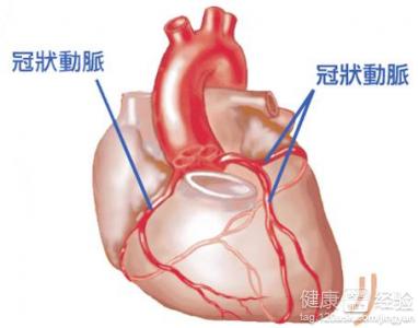 預防冠心病