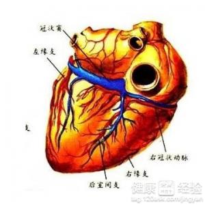 冠心病的幾種治療方案