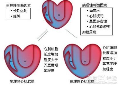 第1步