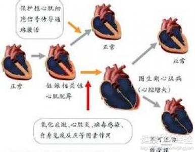 圍生期心肌病症狀的病因是怎麼造成的？