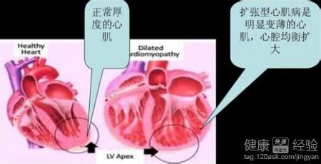 第1步