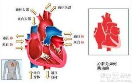 擴張型心肌病能放起搏器嗎