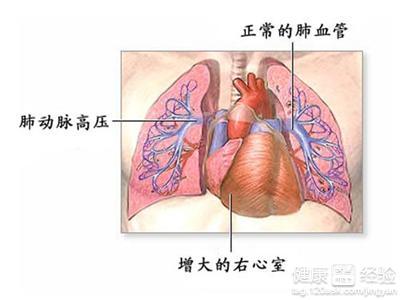 第1步