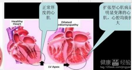 第1步