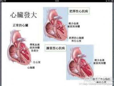 第2步